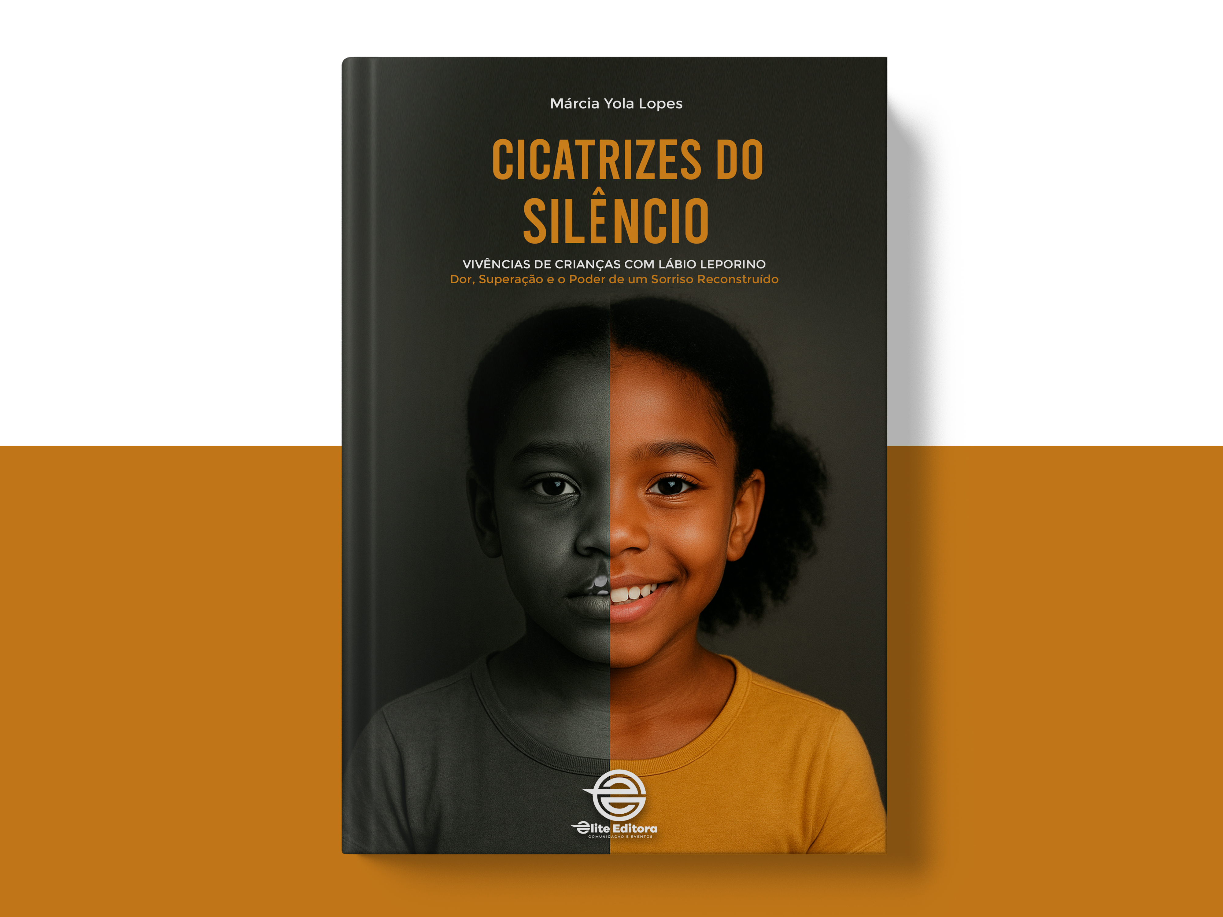 Capa do livro CICATRIZES DO SILÊNCIO - Vivências de Crianças com Lábio Leporino (Dor, Superação e o Poder de um Sorriso Reconstruído)